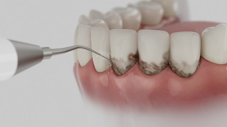 Trusted Invisalign Clear Aligners service in Fritch, TX - Dentist Open Now
